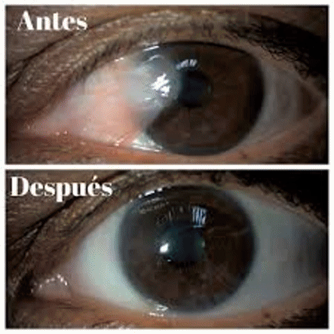 Vitaminas para Ojos Saludables